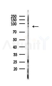Phospho-PAK6 (Ser165) Antibody - Western blot analysis of lysates from 293 cells(UV 30min treatment), using Phospho-PAK6 (Ser165) Antibody at 1/1000 dilution.