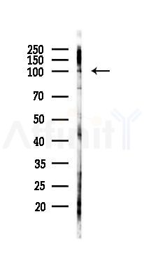 Phospho-HDAC7 (Ser486) Antibody - Western blot analysis of lysates from 293 cells(UV 30min treatment), using Phospho-HDAC7 (Ser486) Antibody at 1/1000 dilution.