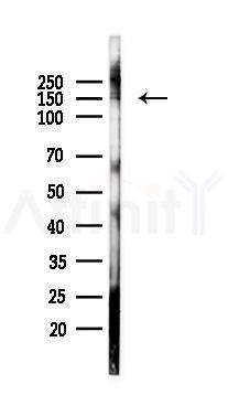 Phospho-PLCG1 (Ser1248) Antibody - Western blot analysis of lysates from 293 cells(UV 30min treatment), using Phospho-PLCG1 (Ser1248) Antibody at 1/1000 dilution.