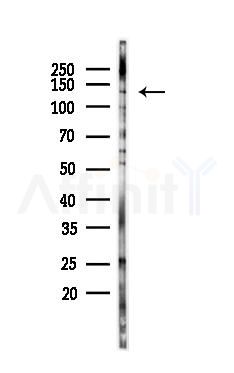 Phospho-EPHA7 (Tyr608) Antibody - Western blot analysis of lysates from K562 cells(UV 30min treatment), using Phospho-EPHA7 (Tyr608) Antibody at 1/1000 dilution.