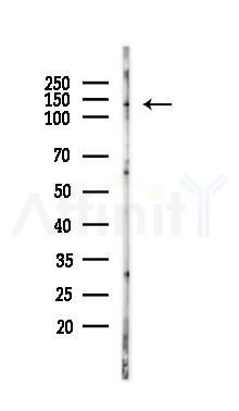 Phospho-EPHA7 (Tyr608) Antibody - Western blot analysis of lysates from 293 cells(UV 30min treatment), using Phospho-EPHA7 (Tyr608) Antibody at 1/1000 dilution.