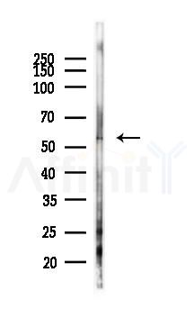 Phospho-Epo-R (Tyr456) Antibody - Western blot analysis of lysates from Mouse lung, using Phospho-Epo-R (Tyr456) Antibody at 1/1000 dilution.