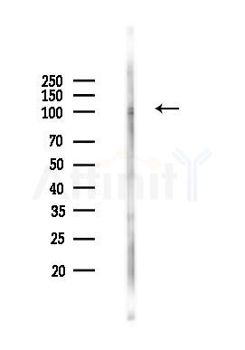 Phospho-ROR2 (Ser449) Antibody - Western blot analysis of lysates from K562 cells(heat-shock 45min treatment), using Phospho-ROR2 (Ser449) Antibody at 1/1000 dilution.