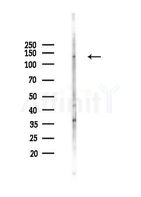 Phospho-Bamacan (Ser1083) Antibody - Western blot analysis of lysates from Mouse brain, using Phospho-Bamacan (Ser1083) Antibody at 1/1000 dilution.