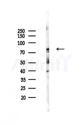 Phospho-SYN2 (Ser425) Antibody - Western blot analysis of lysates from Mouse brain, using Phospho-SYN2 (Ser425) Antibody at 1/1000 dilution.