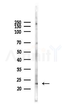 MRLC1/MRLC2 Antibody - Western blot analysis of lysates from HUVEC cells(starvation 24h treatment), using MRLC1/MRLC2 Antibody at 1/1000 dilution.