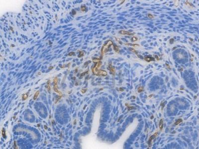 CD31 Recombinant Rabbit mAb - BF3031 at 1/100 staining Mouse uterine tissue by IHC-P.