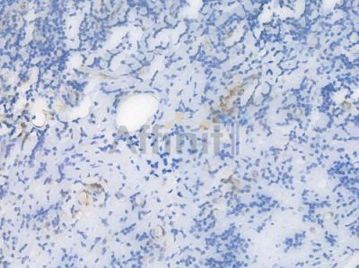CD31 Recombinant Rabbit mAb - BF3031 at 1/100 staining Human tonsil tissue by IHC-P.