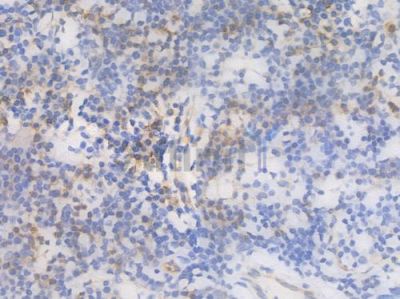 CD31 Recombinant Rabbit mAb - BF3031 at 1/100 staining Human lymph node tissue by IHC-P.