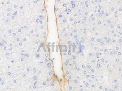 CD31 Recombinant Rabbit mAb - BF3031 at 1/100 staining Human liver tissue by IHC-P.