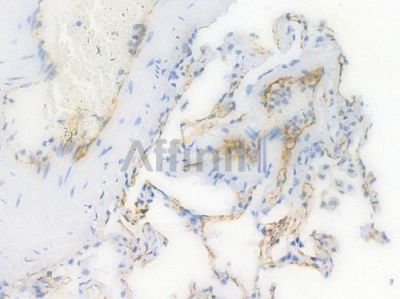 CD31 Recombinant Rabbit mAb - BF3031 at 1/100 staining Human lung tissue by IHC-P.