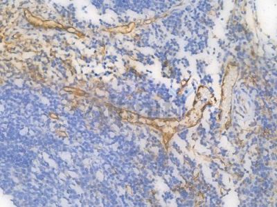 CD31 Recombinant Rabbit mAb - BF3031 at 1/100 staining Human tonsil tissue by IHC-P.