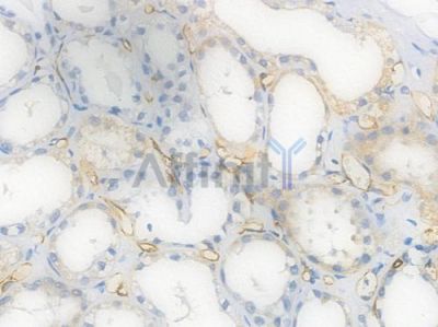 CD31 Recombinant Rabbit mAb - BF3031 at 1/100 staining Human renal tissue by IHC-P.