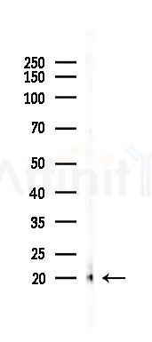 p14 ARF Recombinant Rabbit mAb - Western blot analysis of lysates from 293 cells(UV 30min treatment), using p14 ARF Recombinant Rabbit mAb at 1/1000 dilution.