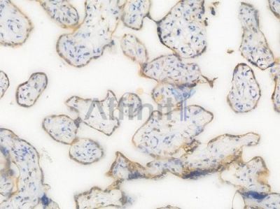 IL1RN Recombinant Rabbit mAb - BF4409 at 1/100 staining Human placental tissue by IHC-P.