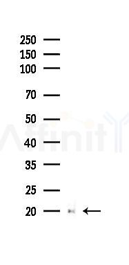 PPIF Recombinant Rabbit mAb - Western blot analysis of lysates from PC12 cells(UV 30min treatment), using PPIF Recombinant Rabbit mAb at 1/1000 dilution.