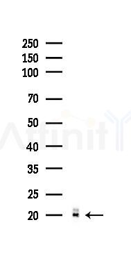 Proteasome 20S LMP2 Recombinant Rabbit mAb - Western blot analysis of lysates from PC12 cells(UV 30min treatment), using Proteasome 20S LMP2 Recombinant Rabbit mAb at 1/1000 dilution.