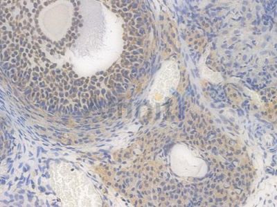 MEKK2 Recombinant Rabbit mAb - BF4417 at 1/100 staining Rat ovarian tissue by IHC-P.
