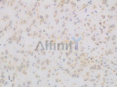 MEKK2 Recombinant Rabbit mAb - BF4417 at 1/100 staining Mouse brain tissue by IHC-P.