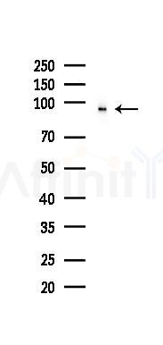 GCN5L2 Recombinant Rabbit mAb - Western blot analysis of lysates from PC12 cells(UV 30min treatment), using GCN5L2 Recombinant Rabbit mAb at 1/1000 dilution.