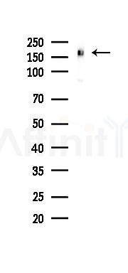EHMT2 Recombinant Rabbit mAb - Western blot analysis of lysates from PC12 cells(UV 30min treatment), using EHMT2 Recombinant Rabbit mAb at 1/1000 dilution.