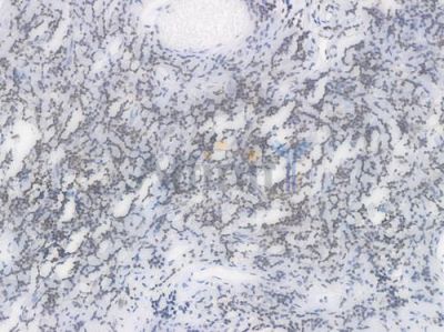 EHMT2 Recombinant Rabbit mAb - BF4422 at 1/100 staining Human tonsil tissue by IHC-P.