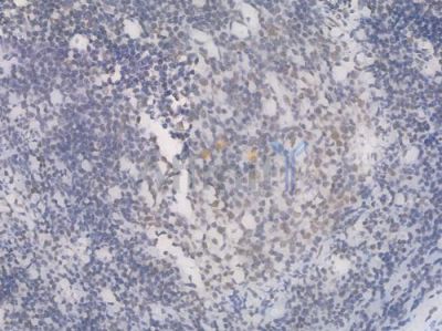EHMT2 Recombinant Rabbit mAb - BF4422 at 1/100 staining Human tonsil tissue by IHC-P.