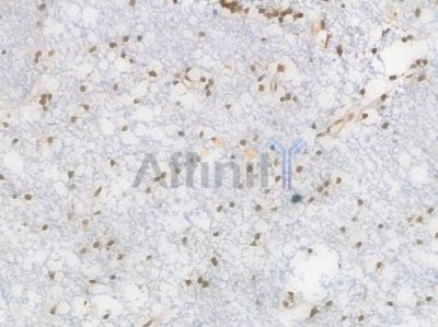 EHMT2 Recombinant Rabbit mAb - BF4422 at 1/100 staining Human brain tissue by IHC-P.