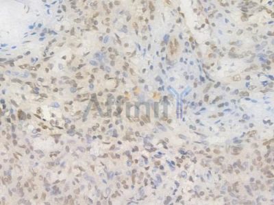 EHMT2 Recombinant Rabbit mAb - BF4422 at 1/100 staining Human spleen tissue by IHC-P.