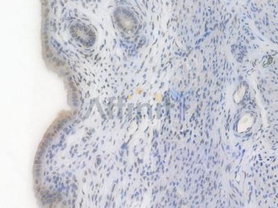 EHMT2 Recombinant Rabbit mAb - BF4422 at 1/100 staining Rat uterine tissue by IHC-P.