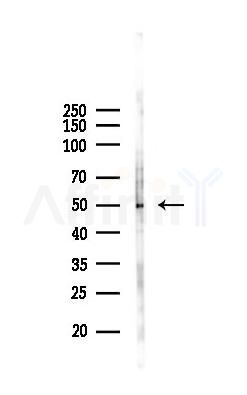 SERPINA3 Recombinant Rabbit mAb - Western blot analysis of lysates from COLO205 cells(LPS 4h treatment), using SERPINA3 Recombinant Rabbit mAb at 1/1000 dilution.