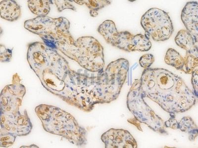 HRAS Recombinant Rabbit mAb - BF4430 at 1/100 staining Human placental tissue by IHC-P.
