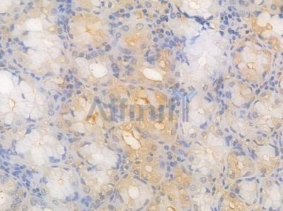 HRAS Recombinant Rabbit mAb - BF4430 at 1/100 staining Human gastric tissue by IHC-P.