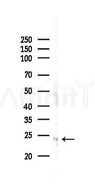 HMGB2 Recombinant Rabbit mAb - Western blot analysis of lysates from Rat lung, using HMGB2 Recombinant Rabbit mAb at 1/1000 dilution.