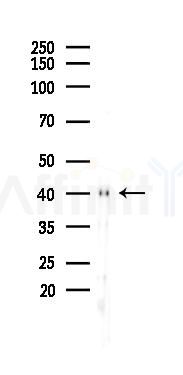 ACADM Recombinant Rabbit mAb - Western blot analysis of lysates from 293 cells(UV 30min treatment), using ACADM Recombinant Rabbit mAb at 1/1000 dilution.