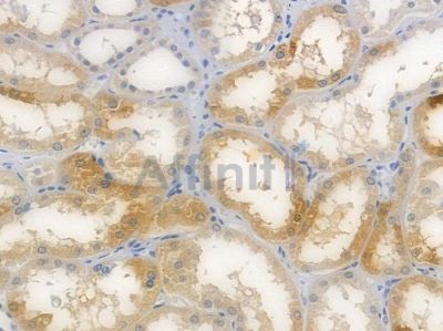 ODC1 Recombinant Rabbit mAb - BF4438 at 1/100 staining Human renal tissue by IHC-P.