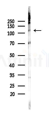 PDE3A Recombinant Rabbit mAb - Western blot analysis of lysates from 293 cells(UV 30min treatment), using PDE3A Recombinant Rabbit mAb at 1/1000 dilution.