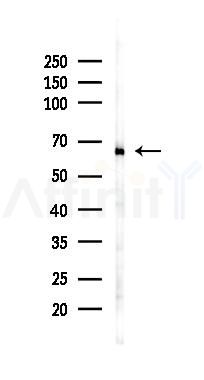 ATIC Recombinant Rabbit mAb - Western blot analysis of lysates from PC12 cells(UV 30min treatment), using ATIC Recombinant Rabbit mAb at 1/1000 dilution.