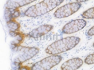 MAOA Recombinant Rabbit mAb - BF4448 at 1/100 staining Human intestinal tissue by IHC-P.