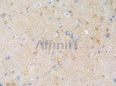 MAOA Recombinant Rabbit mAb - BF4448 at 1/100 staining Human brain tissue by IHC-P.