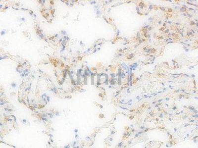 MAOA Recombinant Rabbit mAb - BF4448 at 1/100 staining Human lung tissue by IHC-P.