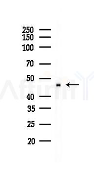 ACTR3 Recombinant Rabbit mAb - Western blot analysis of lysates from PC12 cells(UV 30min treatment), using ACTR3 Recombinant Rabbit mAb at 1/1000 dilution.