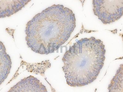 ACTR3 Recombinant Rabbit mAb - BF4452 at 1/100 staining Rat testicular tissue by IHC-P.