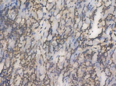 ACTR3 Recombinant Rabbit mAb - BF4452 at 1/100 staining Human tonsil tissue by IHC-P.