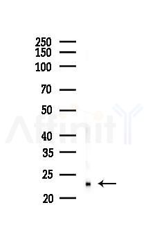 NUDT1 Recombinant Rabbit mAb - Western blot analysis of lysates from 293 cells(UV 30min treatment), using NUDT1 Recombinant Rabbit mAb at 1/1000 dilution.