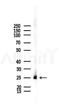 SEC22B Recombinant Rabbit mAb - Western blot analysis of lysates from Rat lung, using SEC22B Recombinant Rabbit mAb at 1/1000 dilution.