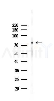 GFPT2 Recombinant Rabbit mAb - Western blot analysis of lysates from Mouse testis, using GFPT2 Recombinant Rabbit mAb at 1/1000 dilution.