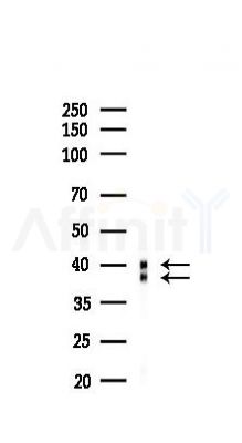 PCBP2 Recombinant Rabbit mAb - Western blot analysis of lysates from Mouse testis, using PCBP2 Recombinant Rabbit mAb at 1/1000 dilution.