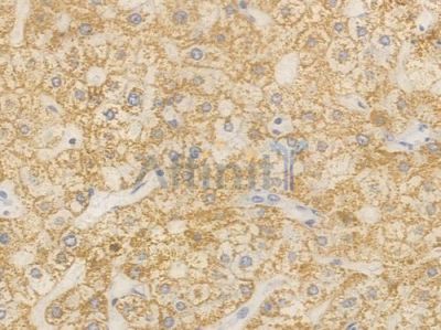 CPS1 Recombinant Rabbit mAb - BF4467 at 1/100 staining Human liver tissue by IHC-P.