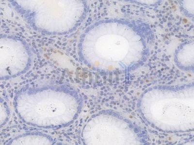 CPS1 Recombinant Rabbit mAb - BF4467 at 1/100 staining Human gastric tissue by IHC-P.